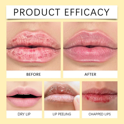 Remove Dark Lip Balm Lightening Melanin Mask Gloss Oil Exfoliating Clean Moisturizer Korean Care Products Makeup Beauty Health